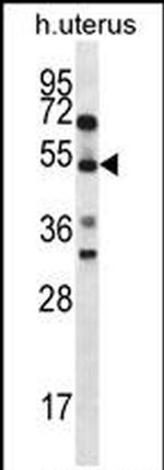 ABRA Antibody in Western Blot (WB)