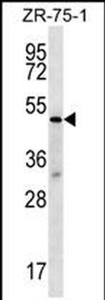 TBL2 Antibody in Western Blot (WB)
