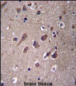 PHACTR3 Antibody in Immunohistochemistry (IHC)
