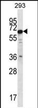 PHACTR3 Antibody in Western Blot (WB)