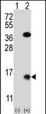 SUMO2 Polyclonal Antibody