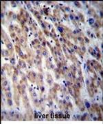 CPN1 Antibody in Immunohistochemistry (IHC)