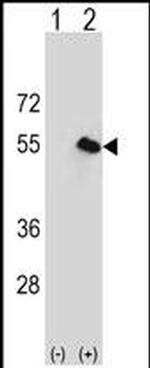 CPN1 Antibody in Western Blot (WB)