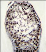 Glycerol kinase Antibody in Immunohistochemistry (IHC)