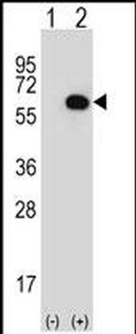 Glycerol kinase Antibody in Western Blot (WB)