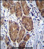 ZCRB1 Antibody in Immunohistochemistry (IHC)