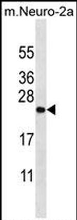ZCRB1 Antibody in Western Blot (WB)