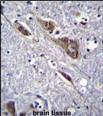 ELAVL2 Antibody in Immunohistochemistry (IHC)