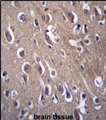 PON2 Antibody in Immunohistochemistry (IHC)