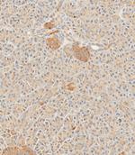 SFRP5 Polyclonal Antibody