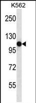 SEMA4C Antibody in Western Blot (WB)