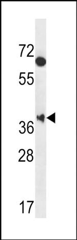 MBNL2 Antibody in Western Blot (WB)