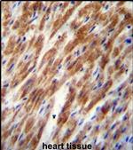 CHI3L2 Antibody in Immunohistochemistry (IHC)