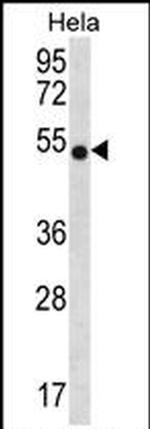 CHI3L2 Antibody in Western Blot (WB)