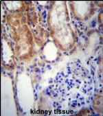 SUSD2 Antibody in Immunohistochemistry (IHC)