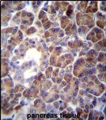 PTDSS2 Antibody in Immunohistochemistry (IHC)