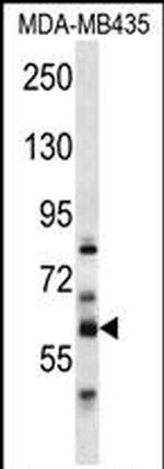PTDSS2 Antibody in Western Blot (WB)