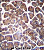 GNAS Antibody in Immunohistochemistry (IHC)