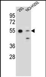 GNAS Antibody in Western Blot (WB)