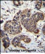 GOLT1B Antibody in Immunohistochemistry (IHC)