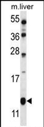 GOLT1B Antibody in Western Blot (WB)