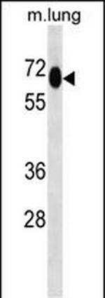 MEPCE Polyclonal Antibody