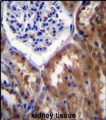 PPP1R15B Antibody in Immunohistochemistry (IHC)