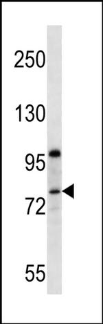 PPP1R15B Antibody in Western Blot (WB)