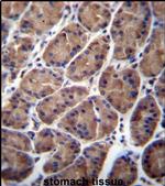PFDN5 Antibody in Immunohistochemistry (IHC)