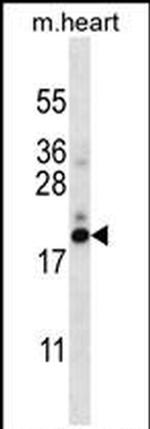 PFDN5 Antibody in Western Blot (WB)