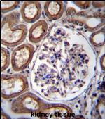 PLS1 Antibody in Immunohistochemistry (IHC)