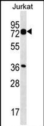PLS1 Antibody in Western Blot (WB)