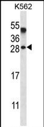 AMELX Antibody in Western Blot (WB)