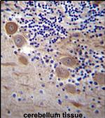SSR2 Antibody in Immunohistochemistry (IHC)