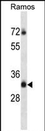 TMEM55B Antibody in Western Blot (WB)