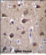 MRAP2 Polyclonal Antibody