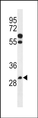 PGAP3 Antibody in Western Blot (WB)