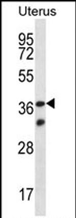 OR4X2 Antibody in Western Blot (WB)