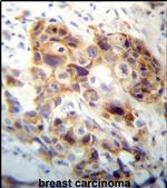 PI15 Antibody in Immunohistochemistry (IHC)
