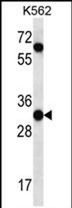 PI15 Antibody in Western Blot (WB)