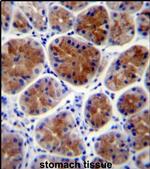 TFCP2L1 Antibody in Immunohistochemistry (IHC)