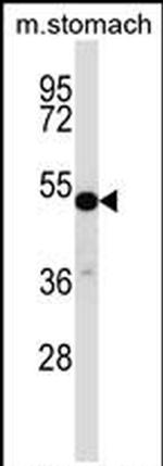 TFCP2L1 Antibody in Western Blot (WB)