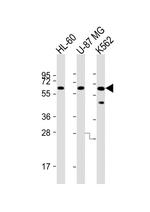 IL1RL2 Polyclonal Antibody