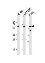 IL1RL2 Antibody in Western Blot (WB)