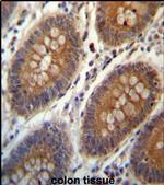 TRIM38 Antibody in Immunohistochemistry (IHC)