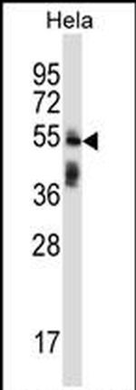 TRIM38 Antibody in Western Blot (WB)