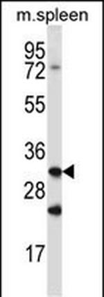 Ctsq Polyclonal Antibody
