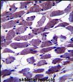MYOM1 Antibody in Immunohistochemistry (IHC)