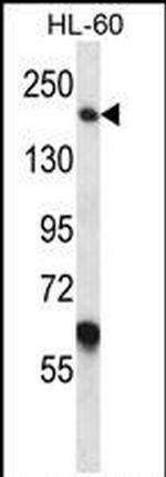 MYOM1 Antibody in Western Blot (WB)