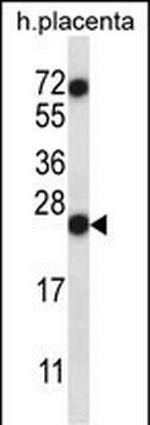 RNASE8 Polyclonal Antibody